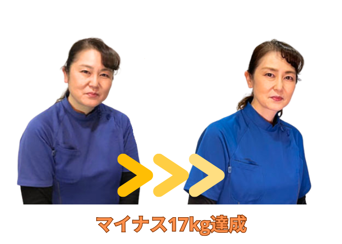 院長のビフォーアフター
